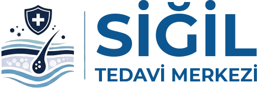 Siğil Tedavisi Gaziantep